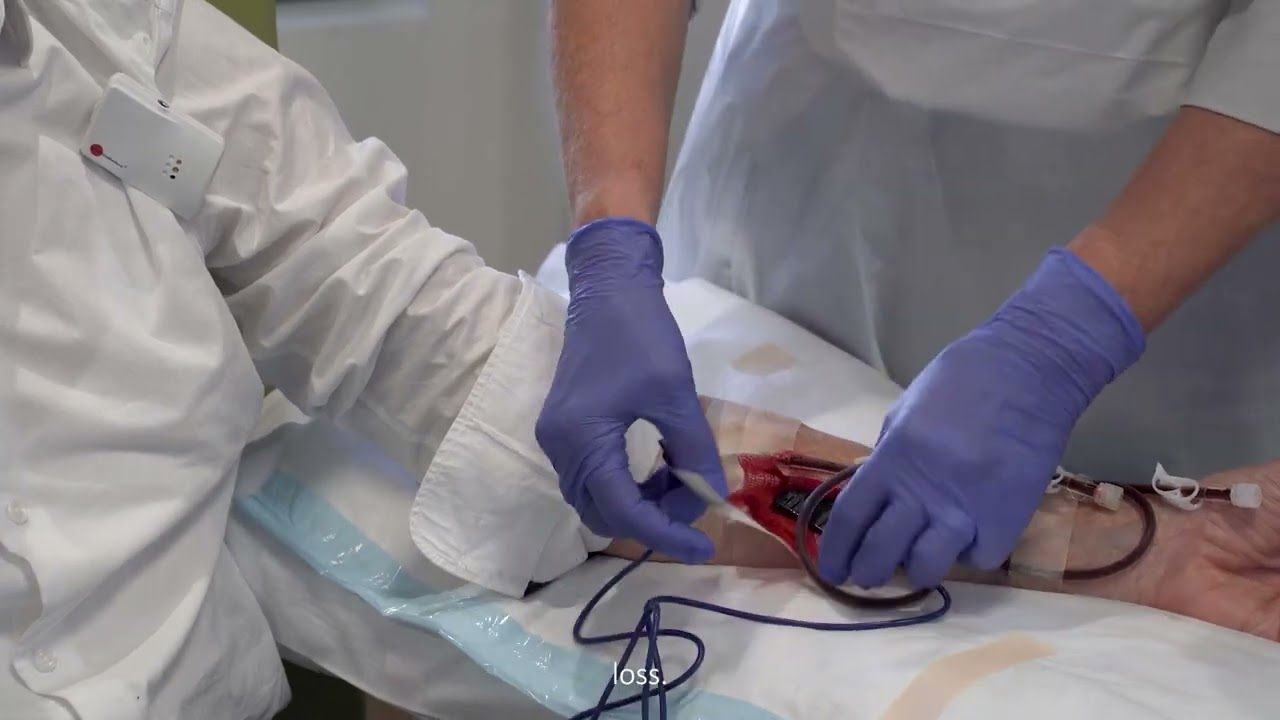 Detecting blood leakage during dialysis therapy